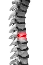 A chiropractor can significantly relieve many pain causing problems related to the spine